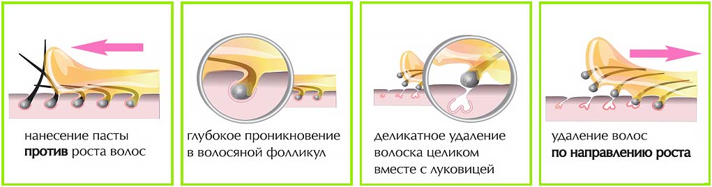 шугаринг технология процедуры